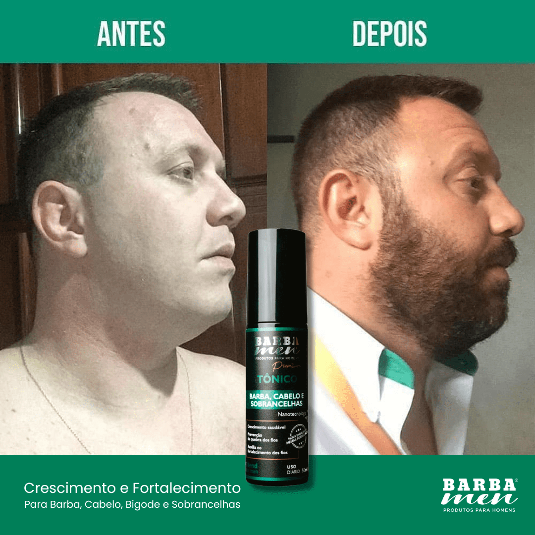 KIT 03 T NICOS FOR MEN PARA CRESCER BARBA CABELO BIGODE